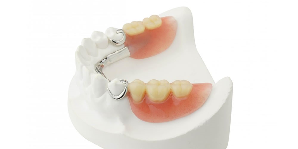 Partial Dentures For Back 
      Teeth Wakenda MO 64687